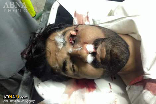 کوئٹہ میں دو بھائیوں پر دھشتگردانہ حملہ، ایک شہید دوسرا زخمی+ تصاویر